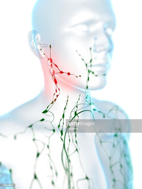 Swollen Lymph Nodes Artwork Foto De Stock Getty Images