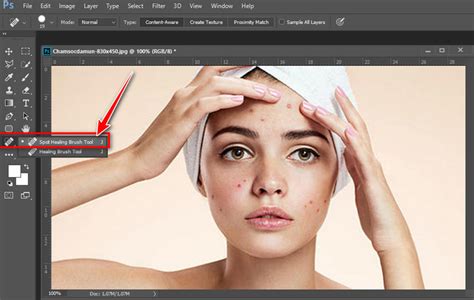Chỉnh Sửa Ảnh Nâng Cao Bằng Công Cụ Spot Healing Brush Trong Photoshop
