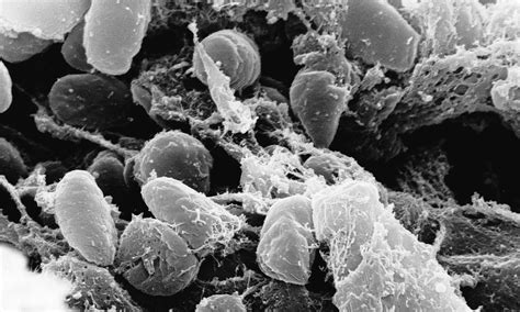 Infectious diseases like the bubonic plague that spread rapidly among a community or region within a short. Bubonic plague killed 20 villagers in Madagascar, health ...