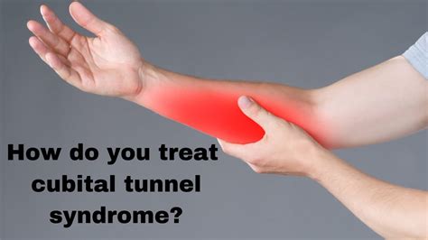 Cubital Tunnel Syndrome Icd 9 Captions Todays