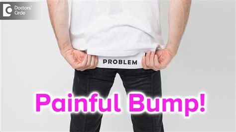 Painful Bump On Buttocks Causes Symptoms Treatment Dr Rajdeep My Xxx Hot Girl