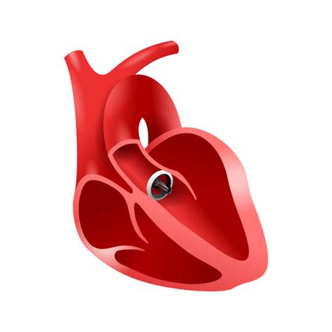 Heart Valve Stock Photos Pictures And Royalty Free Images Istock