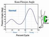 Pictures of Knee Flexion Degrees