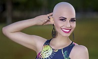 O Dia Mundial do Careca comemora-se em 14 de outubro - REDE JOTA FM