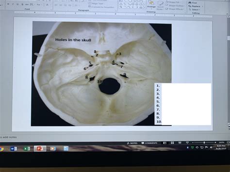 Holes In The Skull Ppt Diagram Quizlet