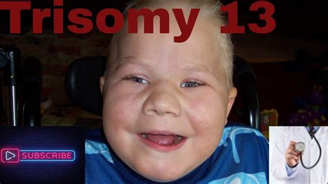 Sindrome De Patau Sindrome De Patau Trissomia Do Cromossomo 13 Otosection