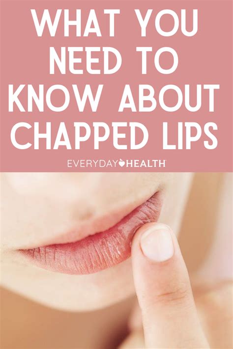 Chapped Lips Causes Treatments And Prevention Everyday Health