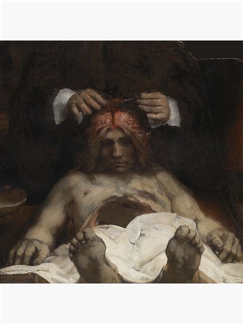 Lienzo La Lección De Anatomía Del Dr Deijman De Rembrandt De
