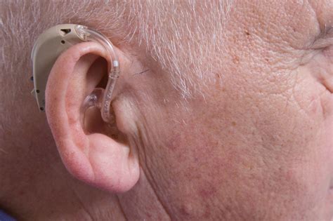 Hearing Aids And Implants NHS