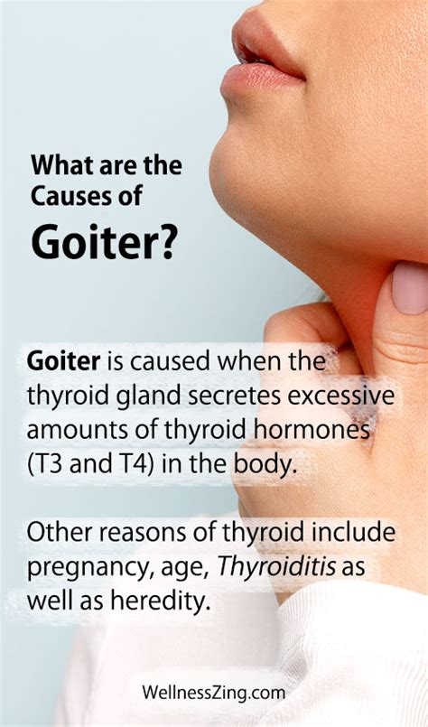 Goiter Treatment How To Shrink Goiter Naturally With Home Remedies