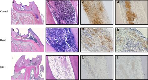 Morphological Characteristics And Expression Of Il6 And Il8 After Pulp Download Scientific