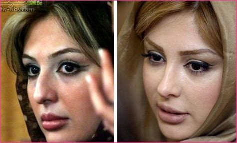 Tehran The Nose Job Capital Of The World Iran Amongst Worlds Top