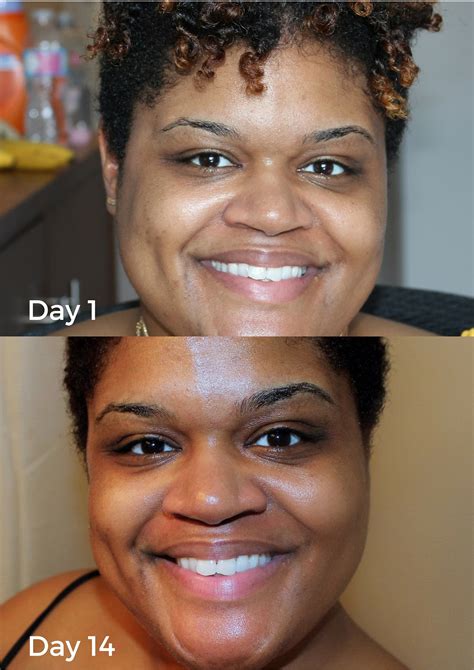 A dermatologist i saw briefly in college i use dove beauty cream bar on my body. Three Ways Dove Beauty Bar Transformed My Skin in 14 Days ...