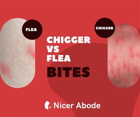 Chigger Bites Vs Flea Bites Which One Is It