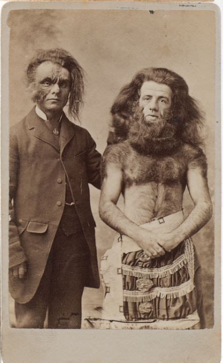 Ca 1860s Two Men Possibly Performers With Face And Body Hair D J