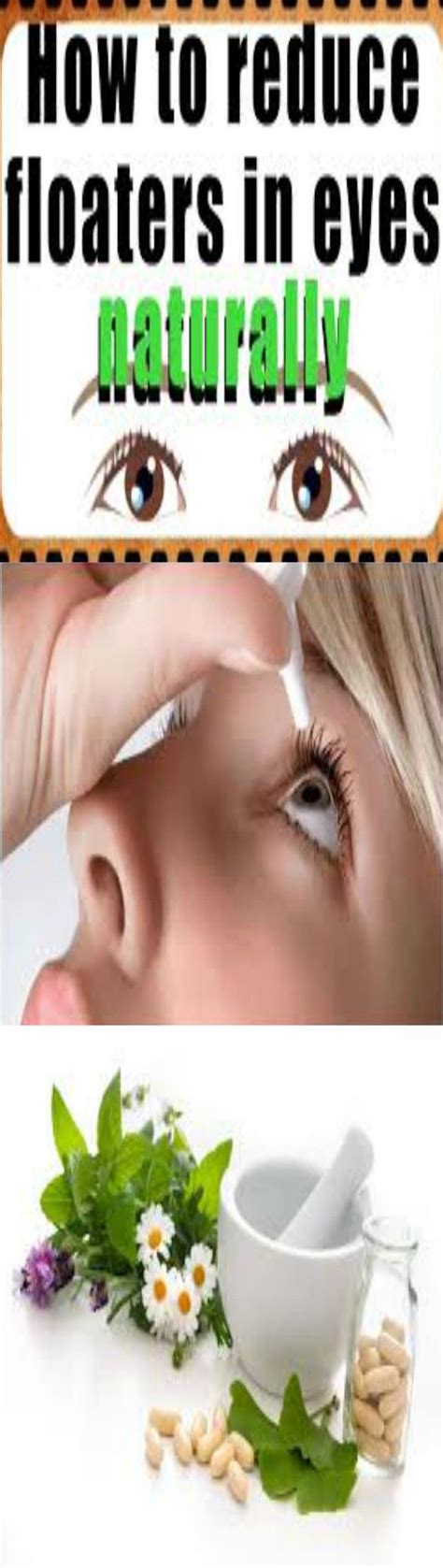 Treatment Of Floaters In The Eye Hobi Akuarium