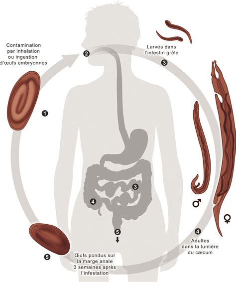 Enterobius vermicularis jellemzői, morfológiája, életciklusa, fertőzés