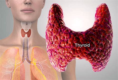 What You Need To Know About Diagnosing And Naturally Treating Thyroid