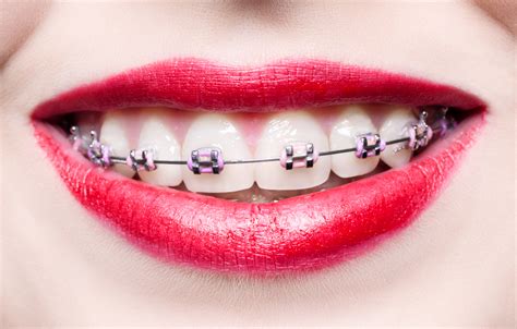 9 Key Dental Problems Braces Can Fix For Adults