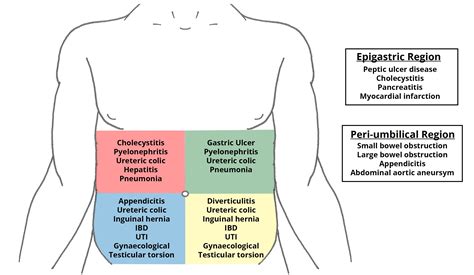 Abdominal Pain Differential Diagnoses Doctornonstop