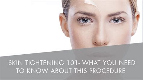 Skin Tightening 101 What You Need To Know About This Procedure