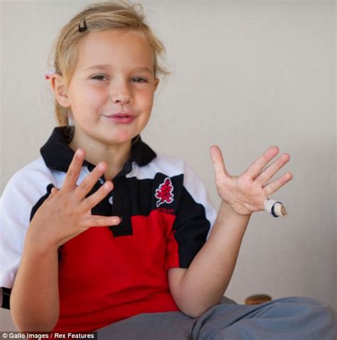 Girl 8 Has Finger Amputated After Being Bitten By Tiger While Visiting Wildlife Park Daily