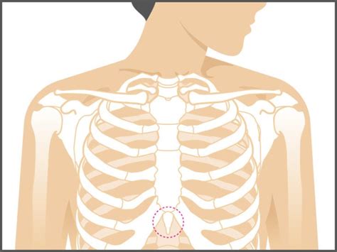 Picture Of What Is Under Your Rib Cage Xiphoid Process Pain Lump