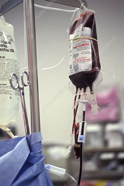 Having a blood transfusion while pregnant can be a frightening scenario. Blood Transfusion - Stock Image - M532/0964 - Science ...
