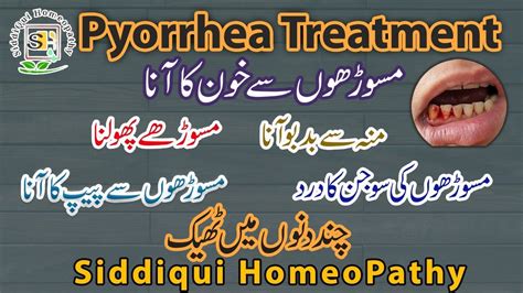 Homeopathic Remedies For Pyorrhea Pyorrhea Cure Pyorrhea Treatment