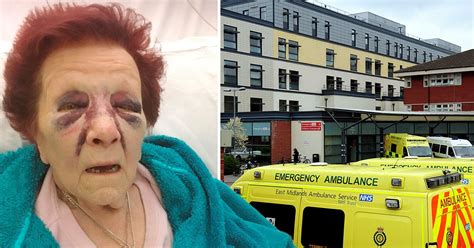 grandmother left with horrific injuries in attack by man posing as cop metro news