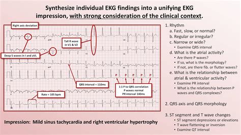 Intro To Ekg Interpretation The 5 Cardinal Rules Youtube