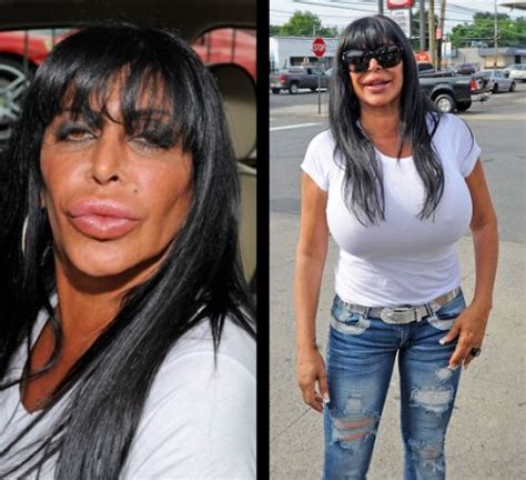 Plastic Surgery Gone Wrong Worst Celebrity Plastic Surgery