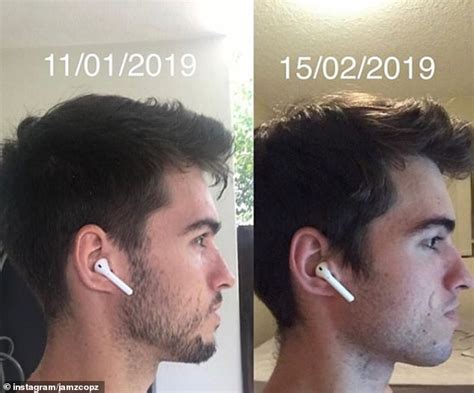 How To Improve Your Jawline With Good Posture Justinboey