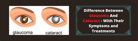 Cataract Surgery How To Recover Safely