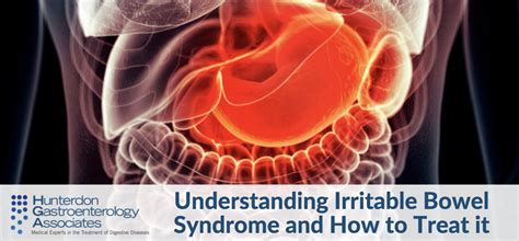 Understanding Irritable Bowel Syndrome And How To Treat It Hunterdon