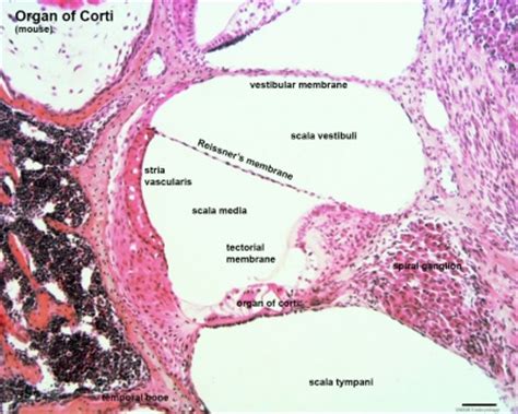 Drag the labels to identify the structures of a long bone. BGDB Face and Ear - Fetal - Embryology