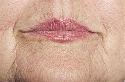 3 Facial Exercises For Upper Lip Lines And Wrinkles Lip Wrinkles How