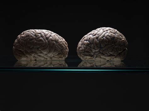 Amazing Photographs Of A Giant Forgotten Collection Of Human Brains
