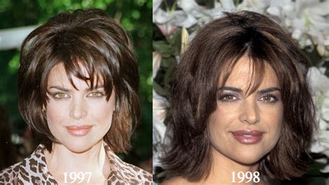 Lisa Rinna Plastic Surgery Before And After Photos Latest Plastic