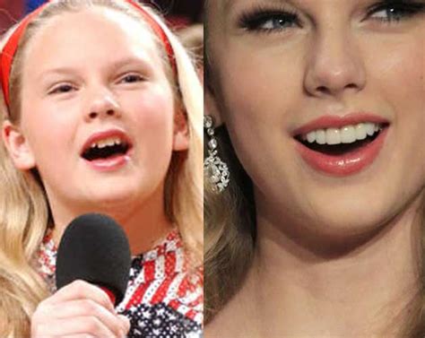 Taylor Swift Plastic Surgery Lets See How Her Looks And Styles Have