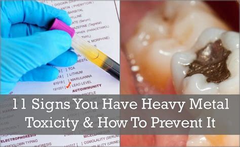 11 Signs You Have Heavy Metal Toxicity And How To Prevent It Heavy