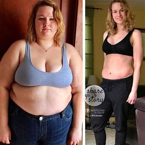 Pin On Before And After Weight Loss
