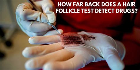 How Far Back Does A Hair Follicle Test Detect Drugs