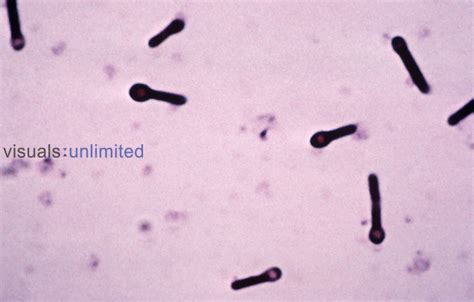 Clostridium Tetani Bacteria Visuals Unlimited