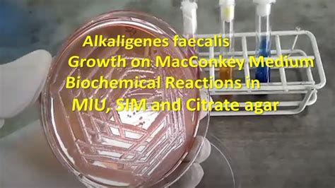 Alkaligenes Faecalis Colony Morphology On Macconkey Agar And