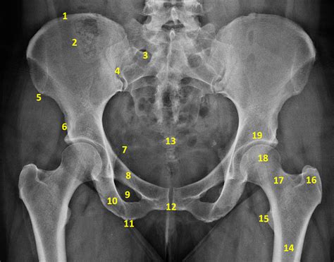 normal pelvis 2 buyxraysonline gambaran