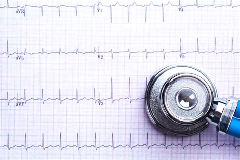 What Is An Ekg Electrocardiogram And How Does It Help Diagnose