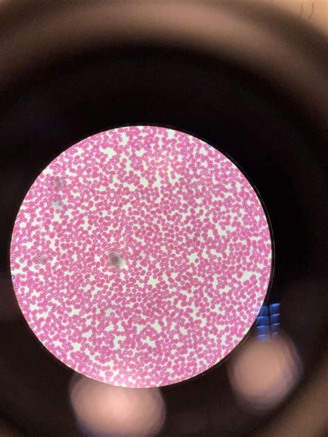 Red And A Few White Blood Cells As Seen Through An Electron My Xxx Hot Girl