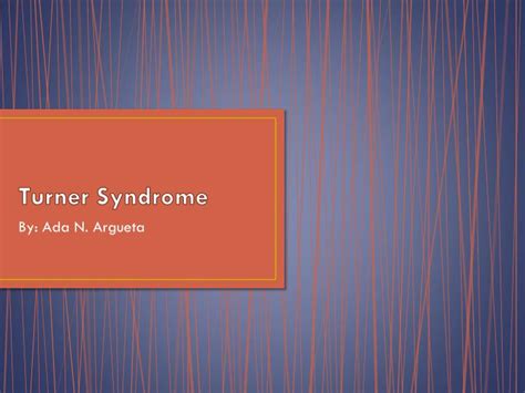 Ppt Turner Syndrome Powerpoint Presentation Free