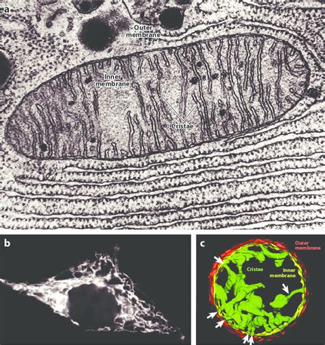 The Morphology Of Mitochondria A Thin Section Electron Micrograph Of